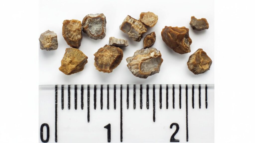 チンゲン菜のシュウ酸を減らす調理法